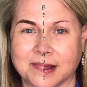 Brows On Fleek For Summer 23